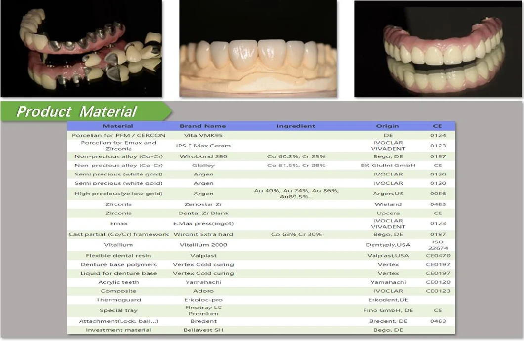 Foo Tian Brand Dental Sports Mouth Guard Made in China Dental Lab in Shenzhen China